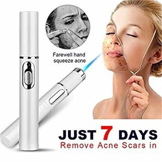Acne Laser Pen Therapy