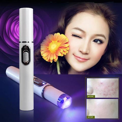 Acne Laser Pen Therapy