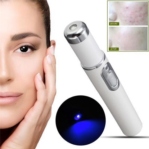 Acne Laser Pen Therapy